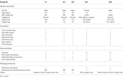 Mutant B3GALT6 in a Multiplex Family: A Dominant Variant Co-Segregated With Moderate Malformations